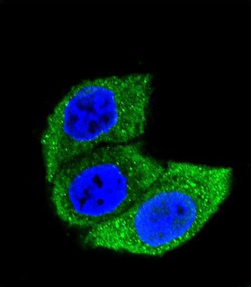 IHC-plus™ Heat Shock Protein 70 / HSPA1A Antibody (aa574-600, clone 201CT8.2.3)