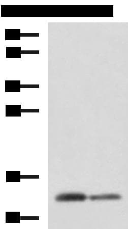 CRABP1 / CRABP Antibody