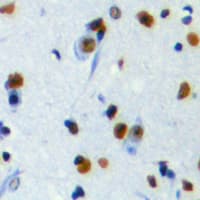Polyclonal Rabbit anti-Human REV3L / REV3 Antibody (aa246-285, IHC, IF, WB)