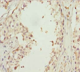 EFHC1 Antibody