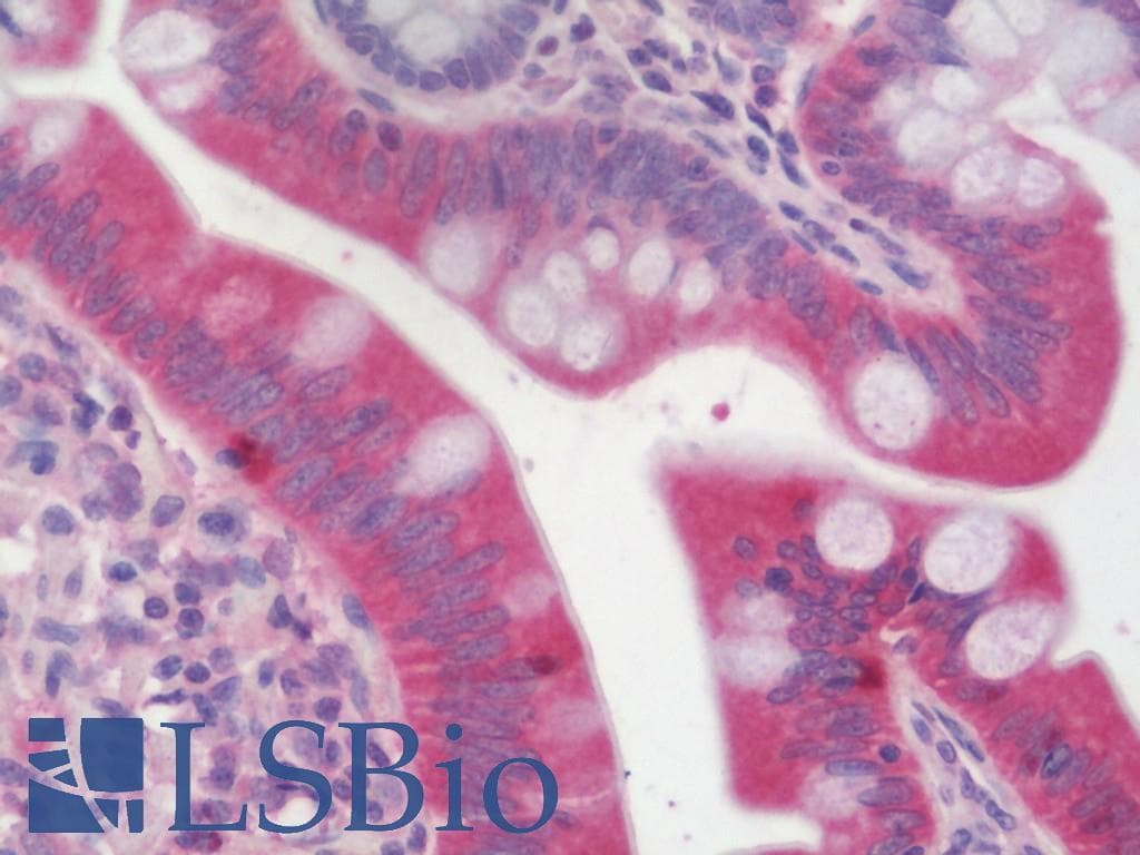 IHC-plus™ TIP30 / HTATIP2 Antibody