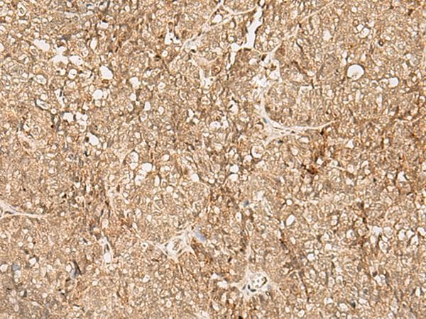 Polyclonal Rabbit anti-Human SNAPC5 Antibody (IHC)