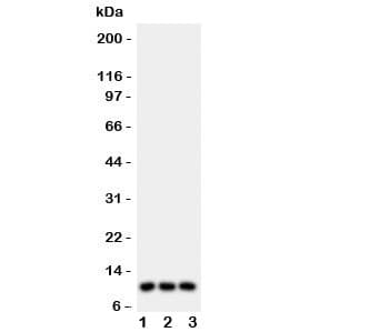 Polyclonal Rabbit anti-Human I-309 / CCL1 Antibody (aa24-96, WB)