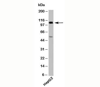 Polyclonal Rabbit anti-Human CYLD Antibody (N-Terminus, WB)