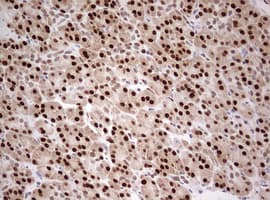 TIPIN Antibody (clone OTI2E6)