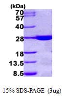 Human HDHD1 Protein (Recombinant His)
