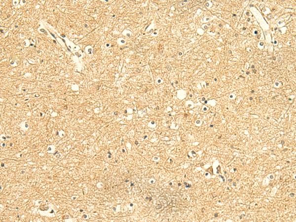 KIAA0513 Antibody
