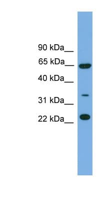 TRAPPC5 Antibody (N-Terminus)