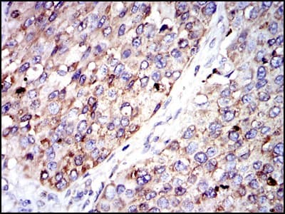 G6PDH Antibody (clone 2H7)