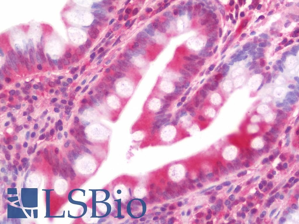 IHC-plus™ SERPINA10 / PZI Antibody (aa186-444)