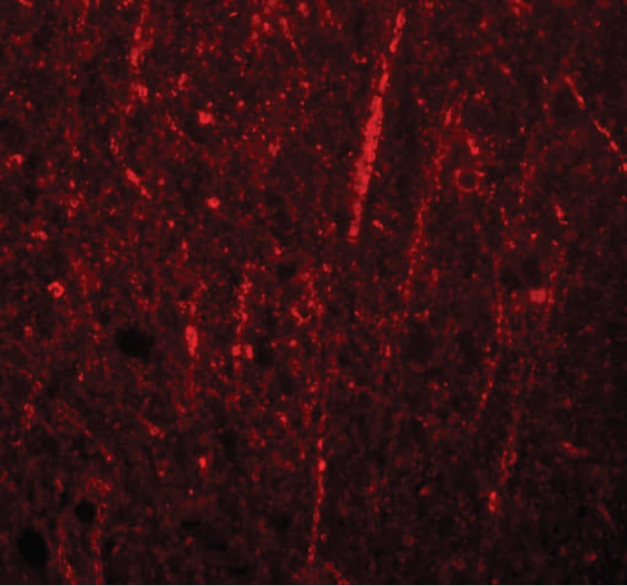 IHC-plus™ FRMPD4 Antibody