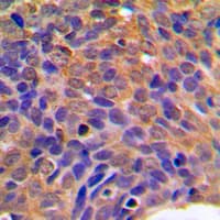 CTNNB1 / Beta Catenin Antibody (C-Terminus)