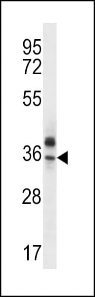OR51Q1 Antibody (aa34-62)