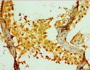 PIKFYVE / PIP5K Antibody (aa1819-2098)