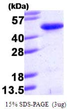 Human PINX1 Protein (Recombinant His)