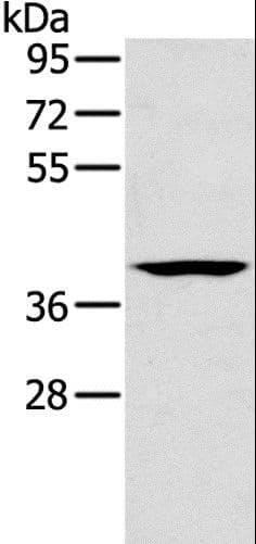 Polyclonal Rabbit anti-Human CAB39 / MO25 Antibody (IHC, WB)