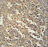 C19orf39 Antibody (aa84-110)