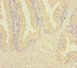 RAB27B Antibody