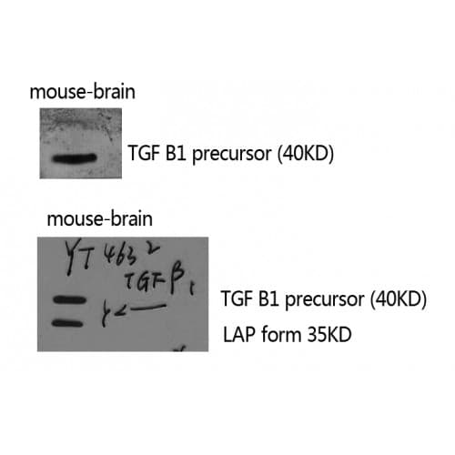 IHC-plus™ TGFB1 / TGF Beta 1 Antibody (310-390 aa, C-terminal)
