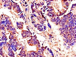 AKAP9 / YOTIAO Antibody