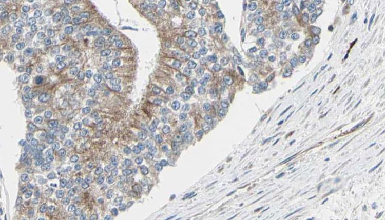 TCP1 Antibody