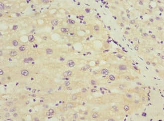 Polyclonal Rabbit anti-Human SOX5 Antibody (IHC)