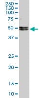 Monoclonal Mouse anti-Human NOVA1 Antibody (clone 5D9, WB)