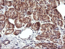 MAP2K3 / MEK3 / MKK3 Antibody (clone OTI5D7)