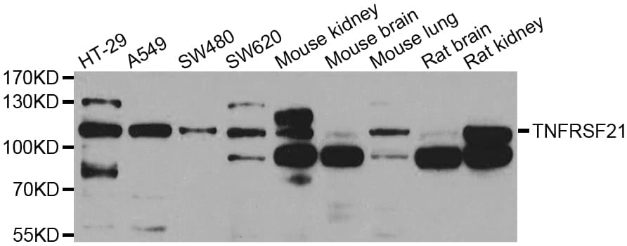 TNFRSF21 / DR6 Antibody