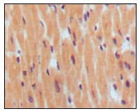 Monoclonal Mouse anti-Human NPPB / BNP Antibody (clone 8D5B4C11, IHC)