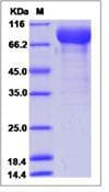 Human KDR / VEGFR2 / FLK1 Protein (Recombinant Human IgG Fc, C-terminus)