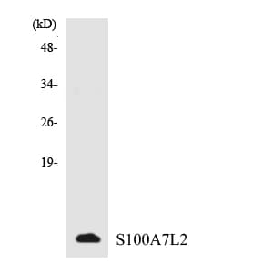 S100A7L2 Antibody (aa23-72)