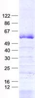 Human Zfp105 / ZNF35 Protein (Recombinant His, N-Terminal)