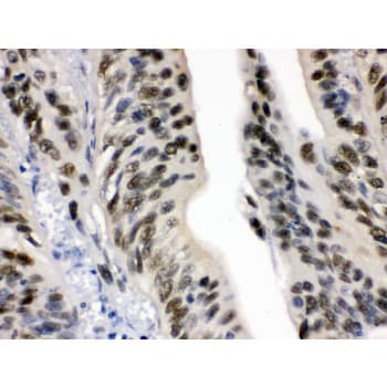 DDB1 Antibody (aa1011-1140)