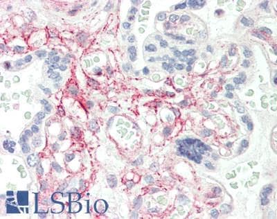 IHC-plus™ Polyclonal Rabbit anti-Human SEPT6 / Septin 6 Antibody (aa208-257, IHC, WB)