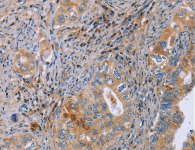 GMFG Antibody