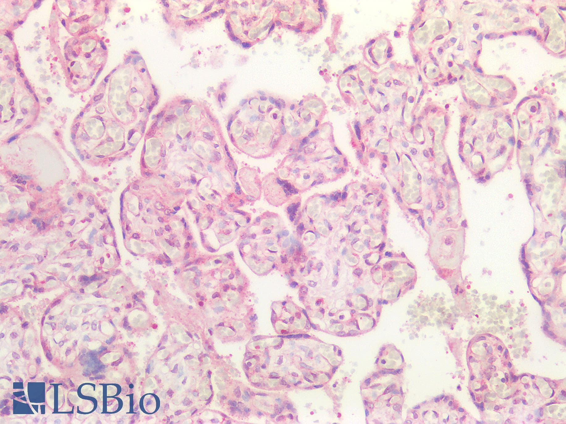 IHC-plus™ Polyclonal Rabbit anti-Human CD276 / B7-H3 Antibody (aa493-522, IHC, IF, WB)