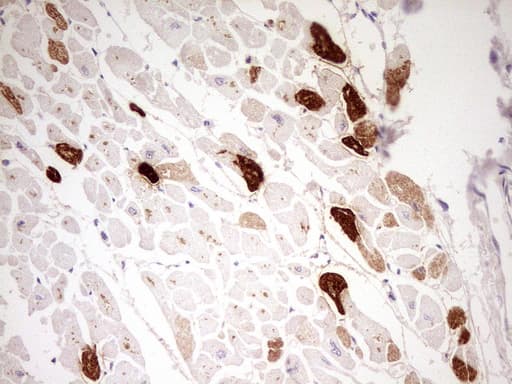 MYL4 Antibody (aa2-197, clone OTI5A8)