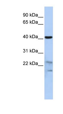 SCRN2 / Ses2 Antibody (N-Terminus)