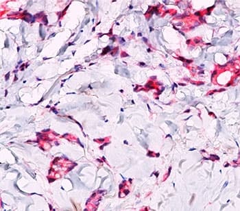 CTNNB1 / Beta Catenin Antibody