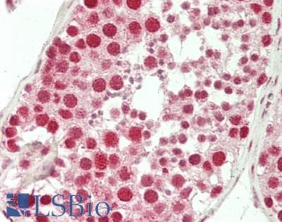 IHC-plus™ PLAGL1 / ZAC Antibody (aa298-347)