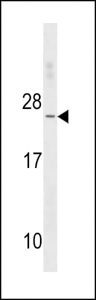 Polyclonal Rabbit anti-Human TNNC2 Antibody (aa97-126, WB)