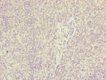 IL36A Antibody