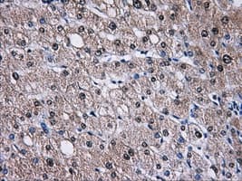 KIAA0153 / TTLL12 Antibody (clone OTI2H10)