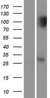SIP / TP53INP1 Protein (Over-Expression Lysate Myc-DDK (Flag))