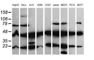 MAP2K1 / MKK1 / MEK1 Antibody (clone OTI4H8, Carrier-free)
