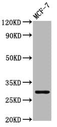 MYOZ2 / CS-1 Antibody
