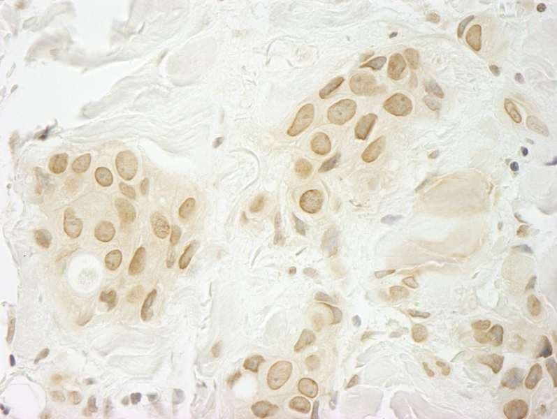 MKRN1 Antibody (aa432-C-term)