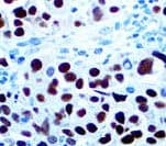 PAX8 Antibody (clone ZR-1, Ready-to-Use)