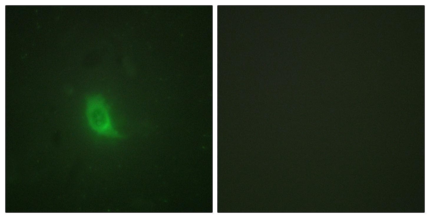 EIF4EBP1 / 4EBP1 Antibody (phospho-Thr69)